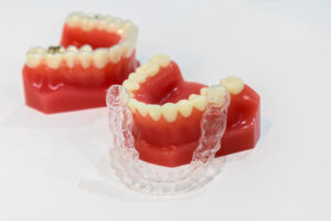 マウスピース矯正