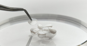 削らないラミネートベニアでは「ブラックフィルム」施術がおすすめ