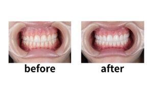 ブラックフィルム ビフォーアフター