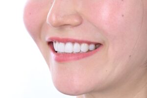 ブラックフィルムの施術インタビュー