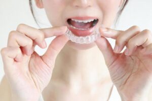 マウスピース矯正