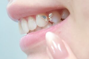 ティースジュエリー