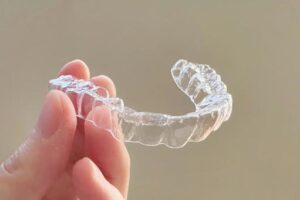 マウスピース矯正