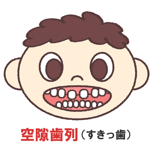 すきっぱ