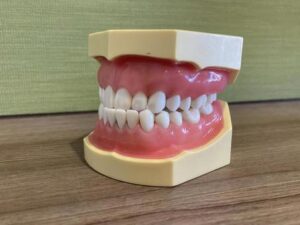 受け口